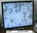 Bloedbeeld_voor_het_bellen_met_gsm_mobiele_telefoon Bloedbeeld_voor_het_bellen_met_gsm_mobiele_telefoon