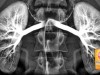 How To Repair Your Kidneys Naturally Using Baking Soda | World Truth.TV How-to-Repair-Your-Kidneys-Naturally-Using-Baking-Soda