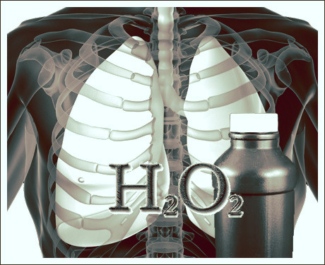 h2o2 Beat Cancer With 35% Hydrogen Peroxide Beat Cancer With 35% Hydrogen Peroxide h2o2
